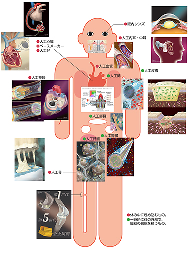 人工臓器とは 日本人工臓器学会