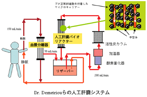 人工肝臓を入れたら普通に生活できますか?